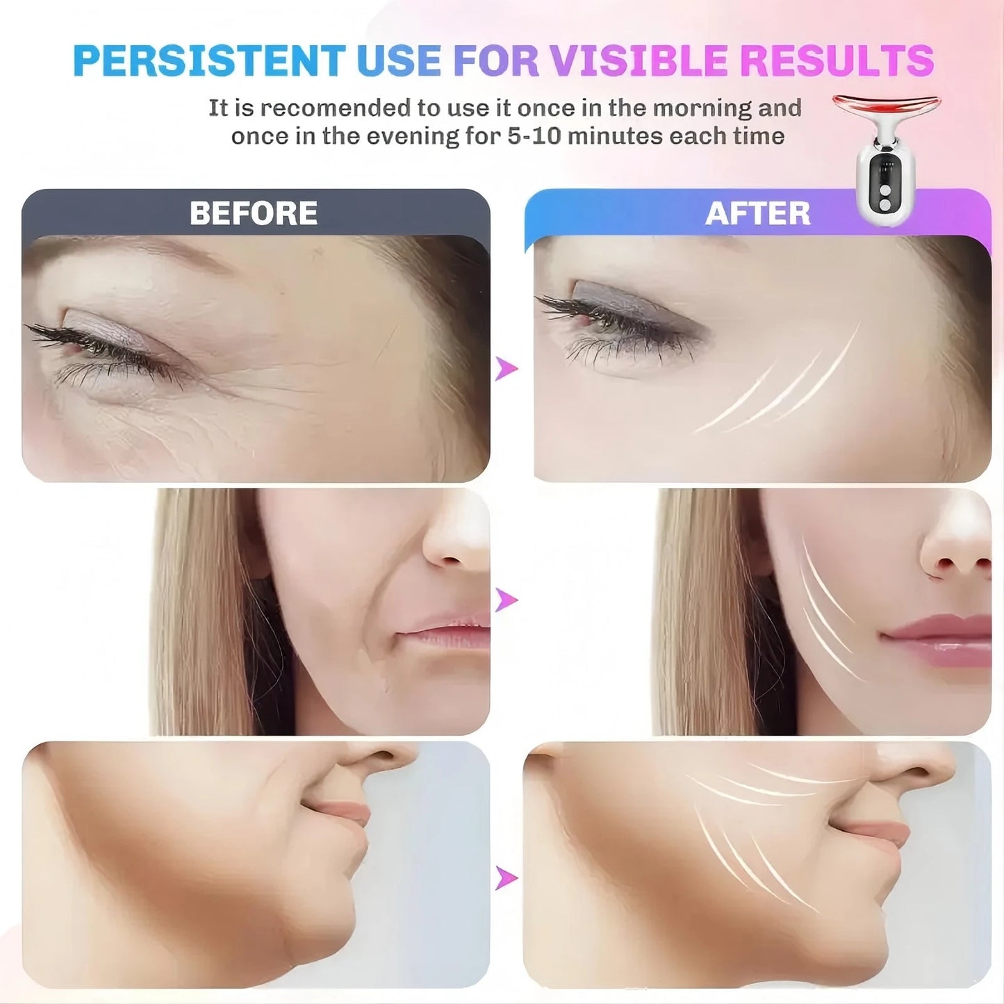 AuraLift EMS & Red Light Facial Rejuvenation Device
